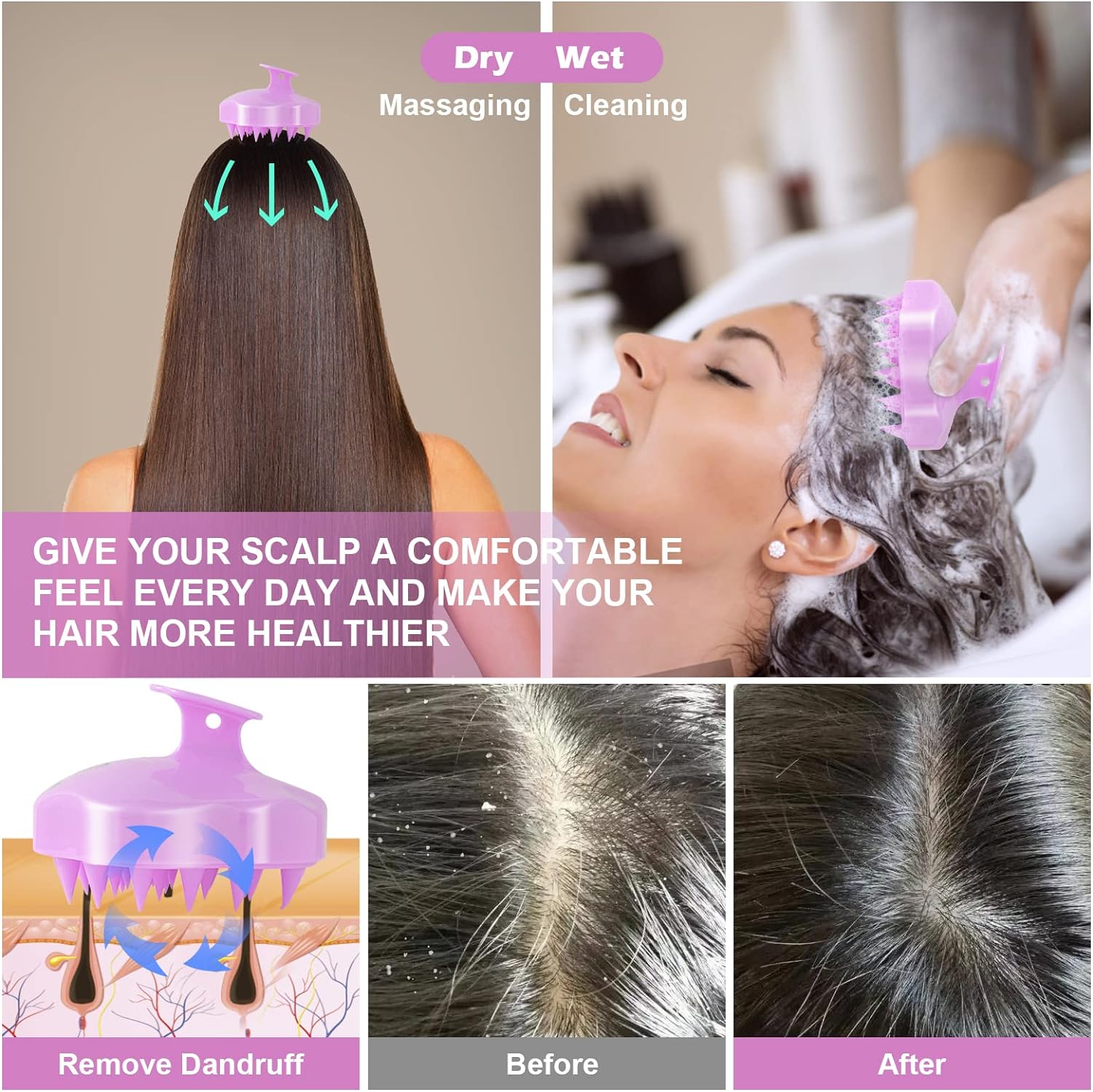 Hair Scalp Massager, Shampoo Brush, Pets Hair Care Tool Hair Scalp Massager, Shampoo Brush, Pets Hair Care Tool